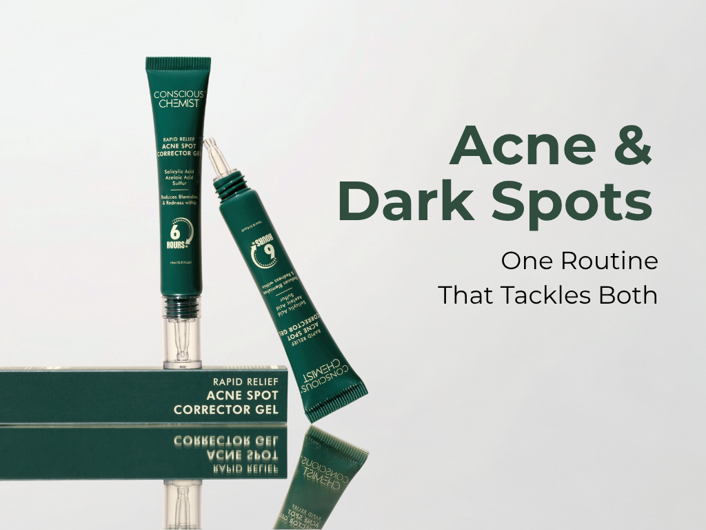 How Can You Treat Acne and Dark Spots in One Routine?