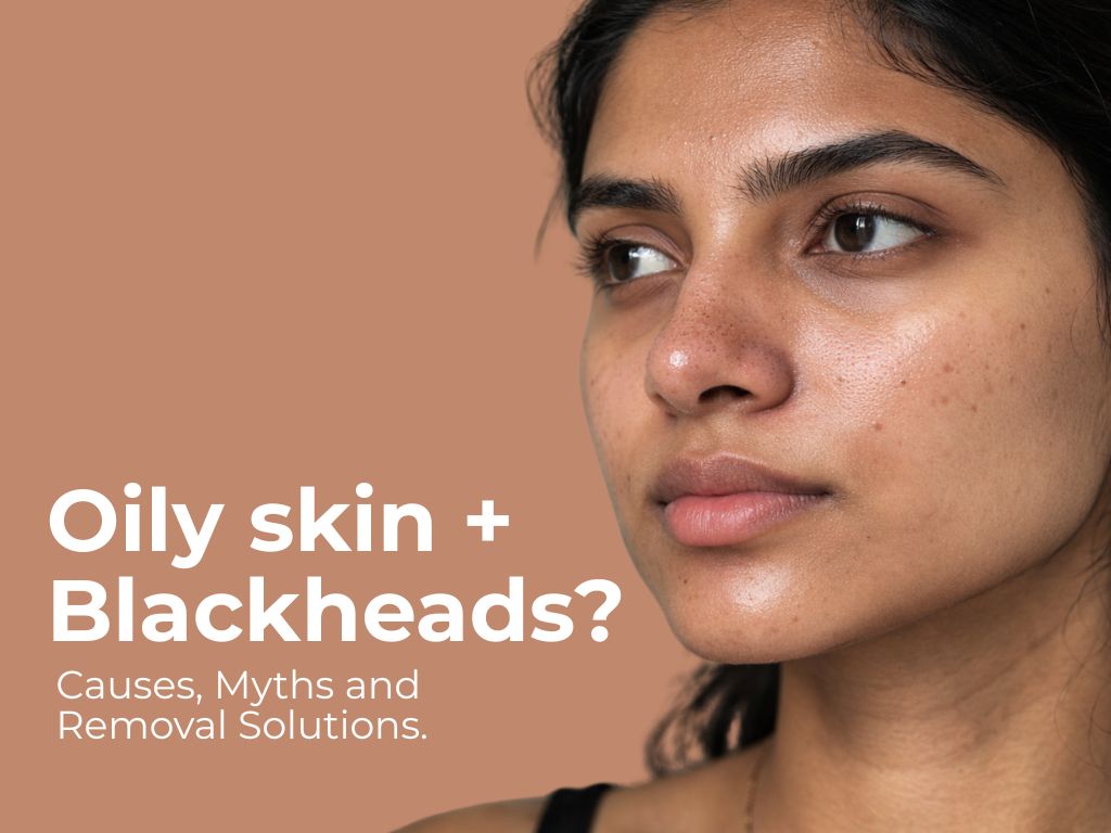 Oily Skin Blackheads: Causes, Myths and Removal Solutions