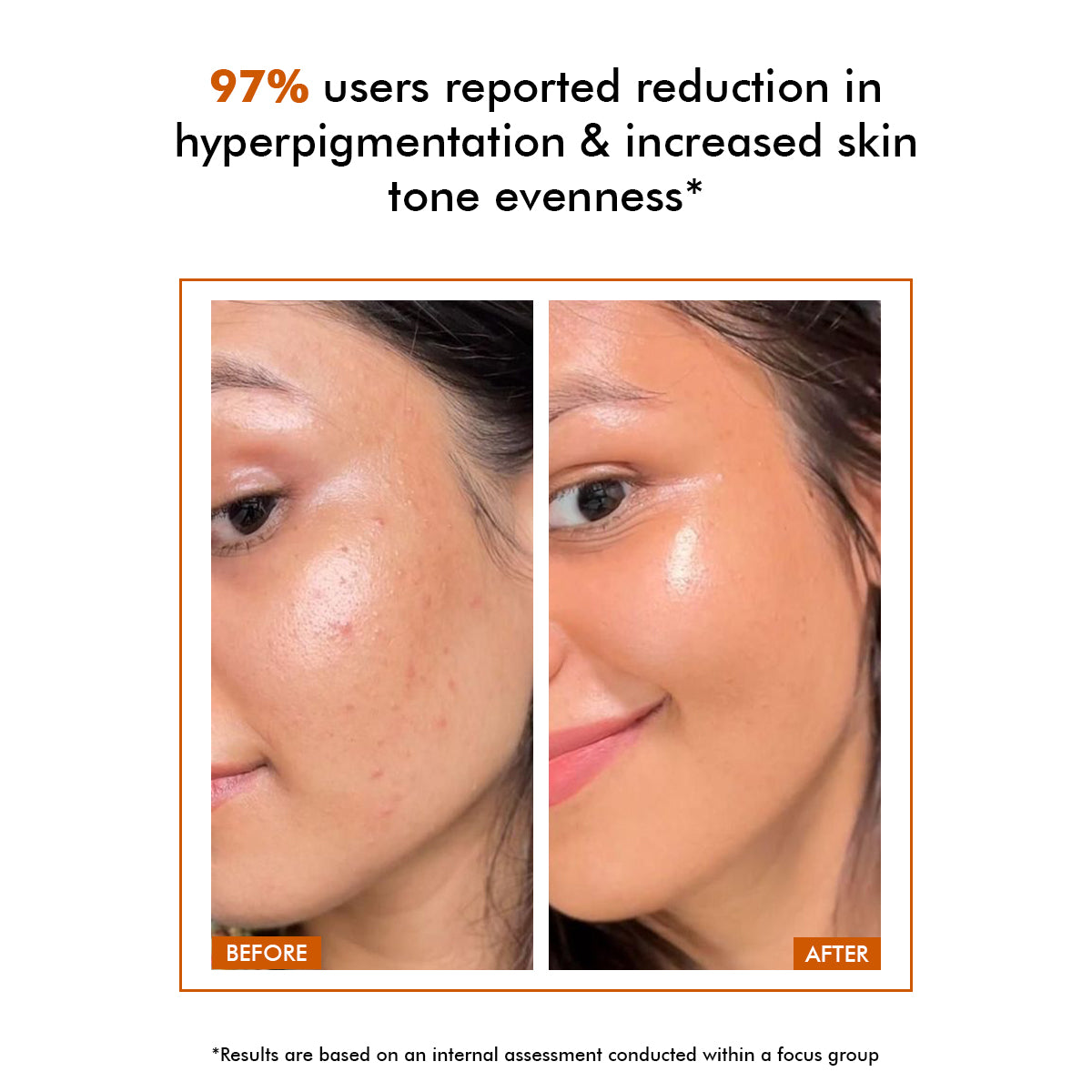 Vivid C | 10% Vitamin C Skin Brightening Serum | 30 ml