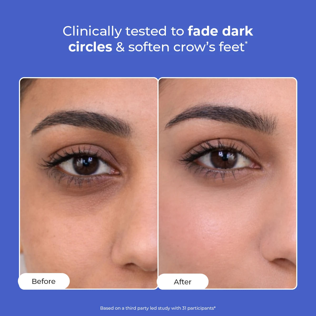 Retinol Peptide Eye Treatment Serum | 15 ml