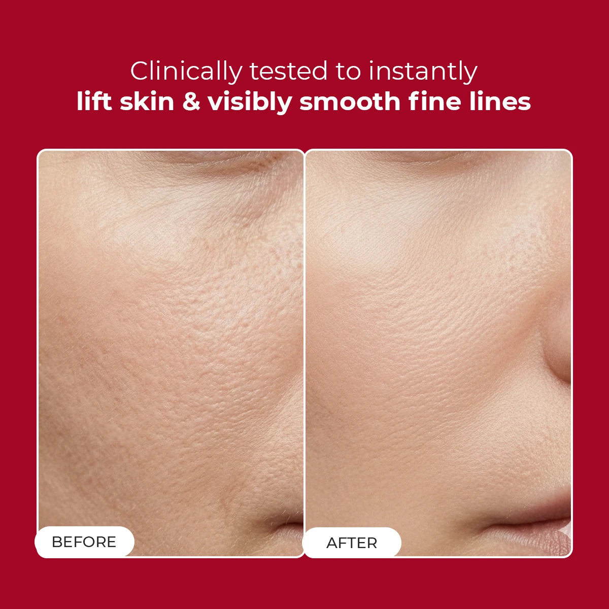 Collagen Jelly Cream | 50 gm