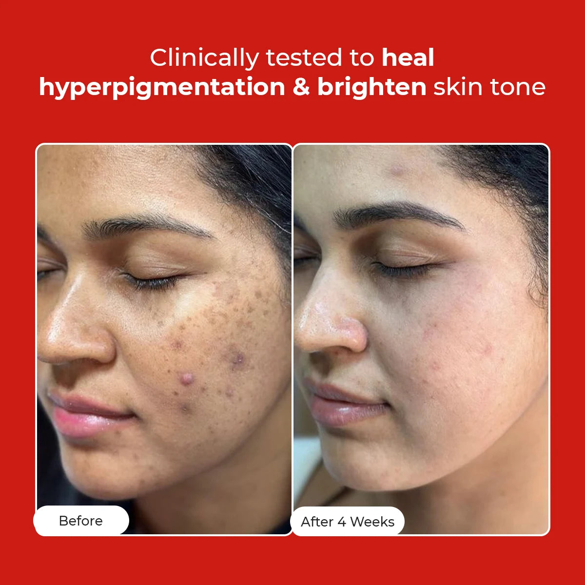 5 Antioxidant Skin Brightening Serum | 50 ml