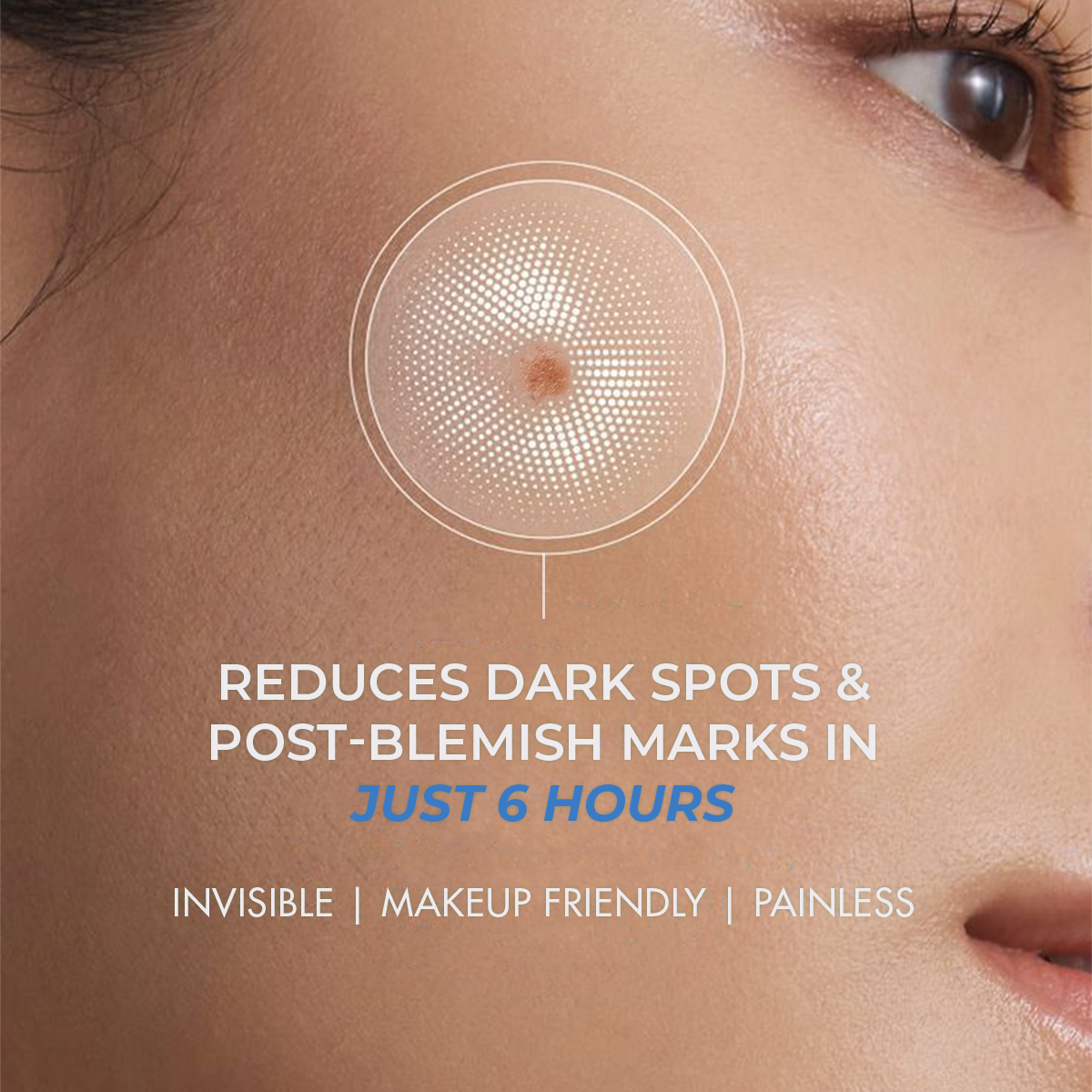 Microneedle Patch For Dark Spot Removal | 4 Patches