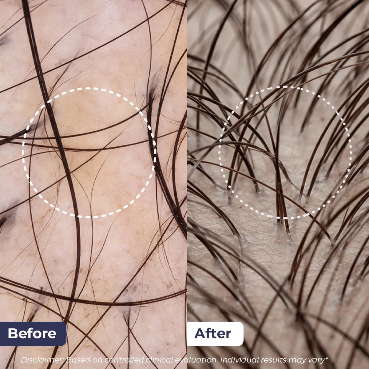 Rosemary Hair Growth Oil | 100 ml