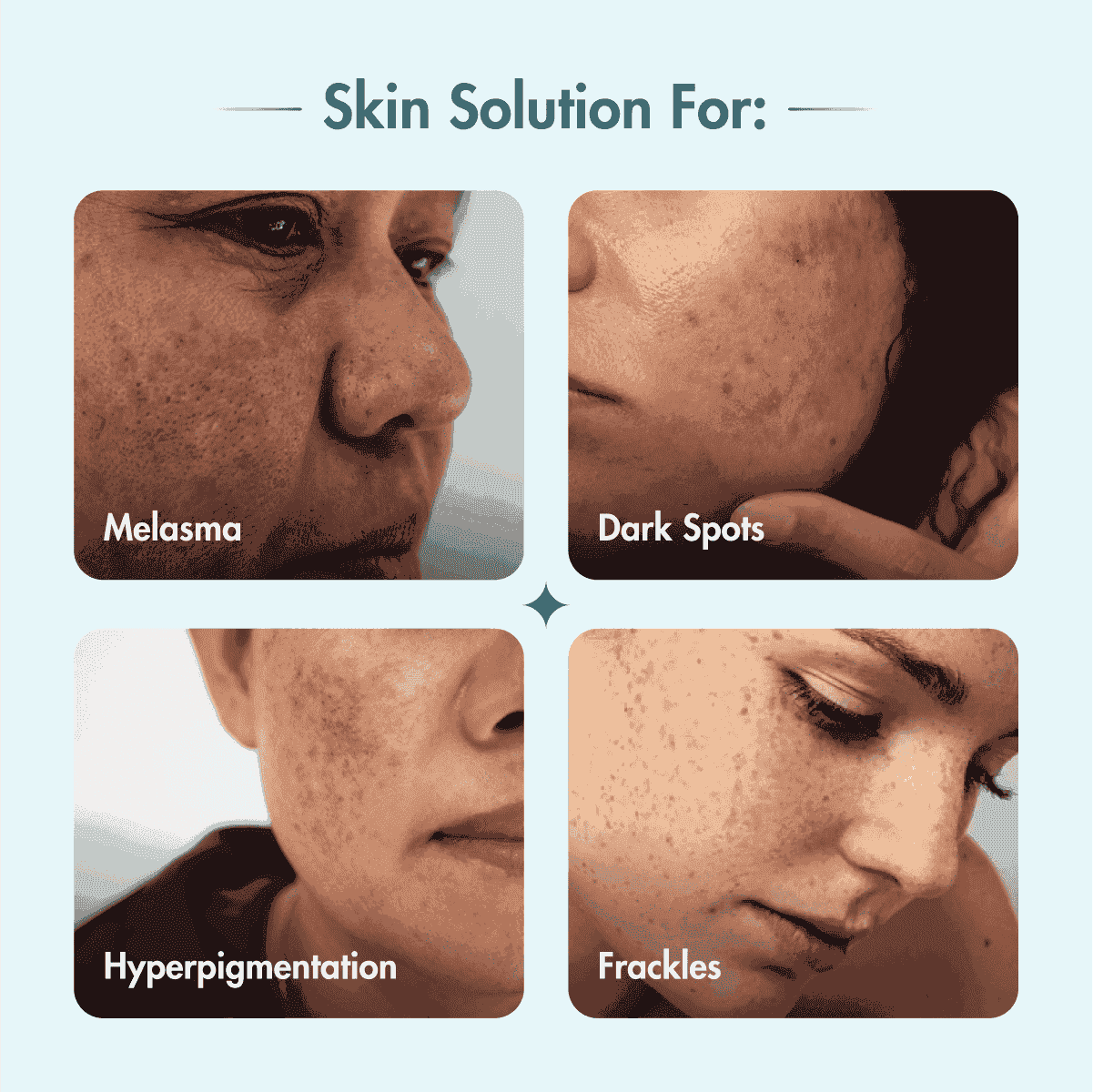 Pack Of Two - Pigmentation & Dark Spot Corrector Gel Cream | Kojic Acid & Niacinamide | 100 gms