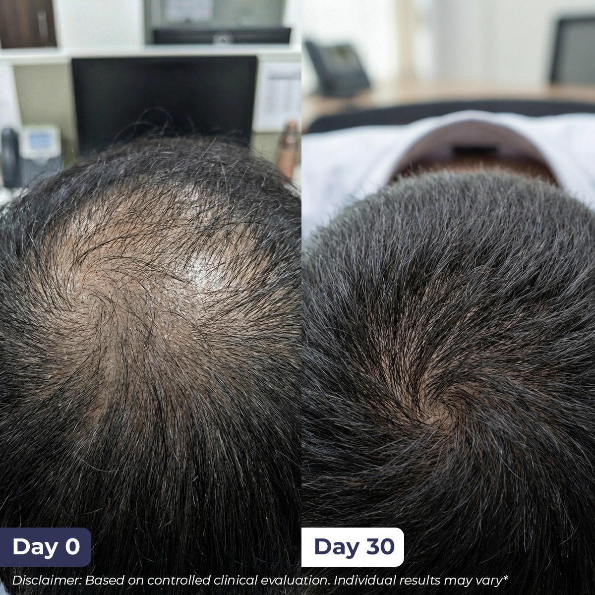 Hair Growth Serum | 30 ml