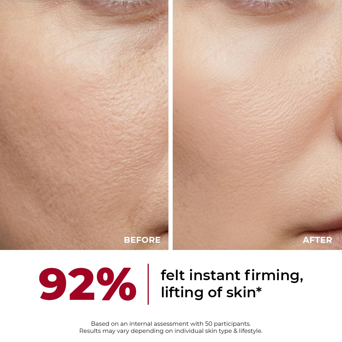 Collagen Jelly Cream | 50 gms | Slashed