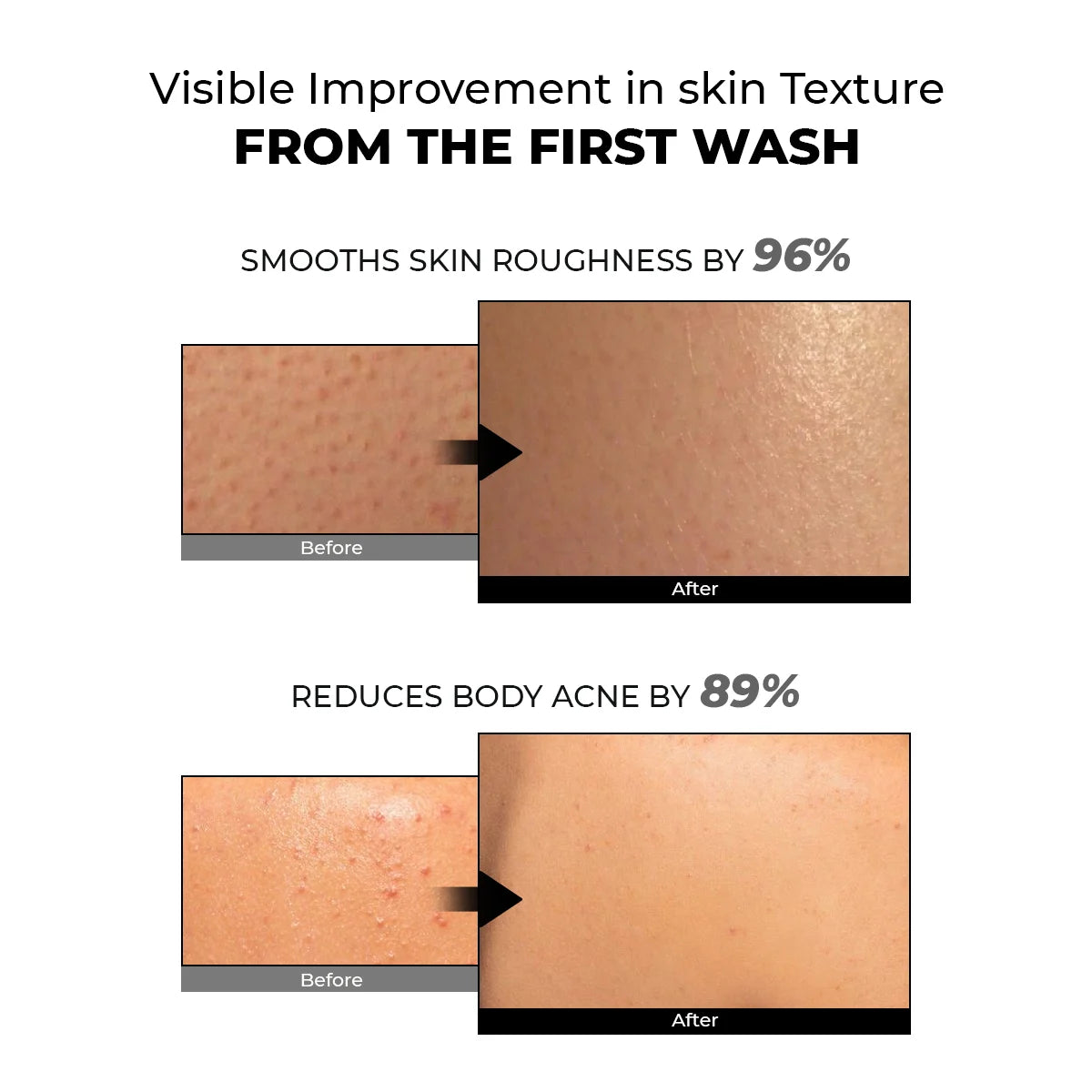 Skin Reset Exfoliating Bodywash | Flash Sale