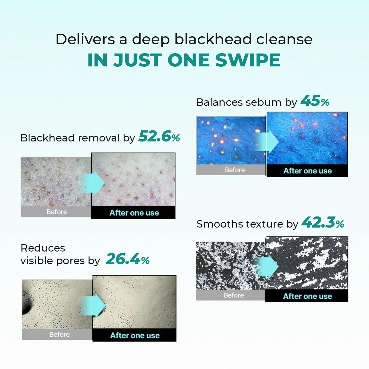 Blackhead Melting Water | 130 ml