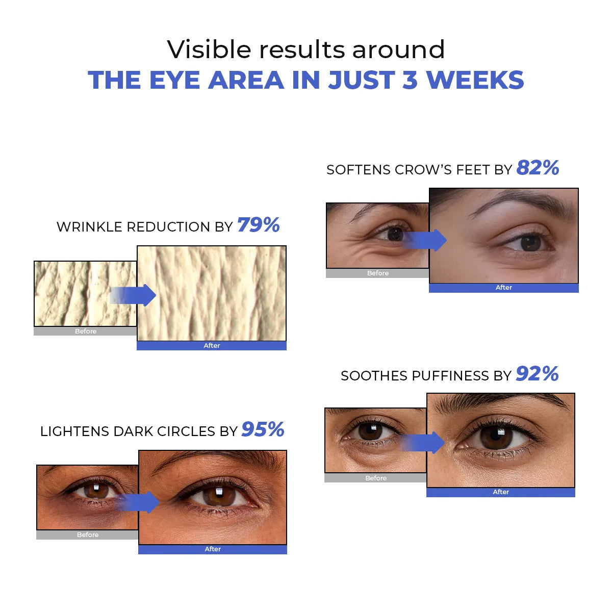 Retinol Peptide Eye Treatment Serum