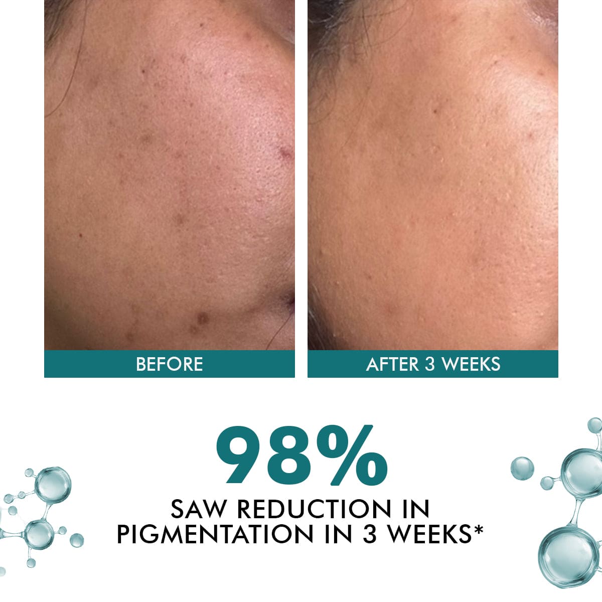 Trubiom Cream Mini | Pack Of Two | 2 x 20 Gms | Special Deal