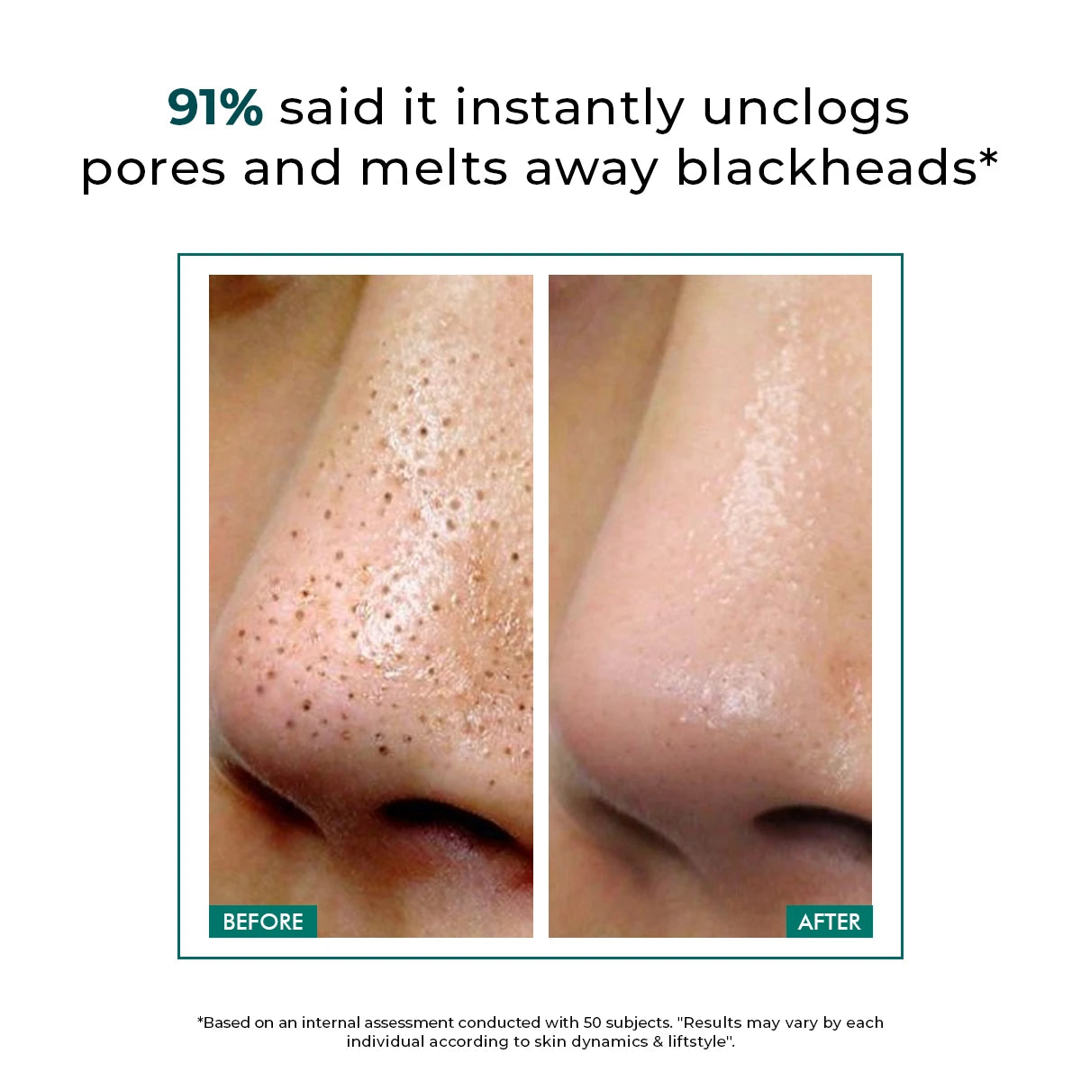Blackhead Removal Trio | Blackhead Melting Water Mini- 2 x 50 ml & Silicone Brush