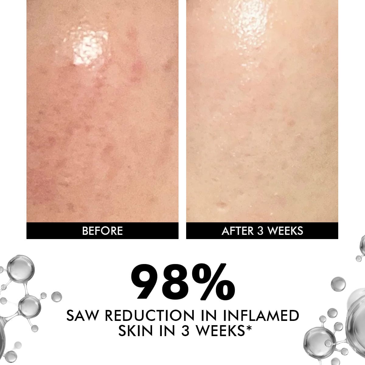 Snail Magic Cream Mini | Pack Of Two | 2 x 20 Gms | Special Deal