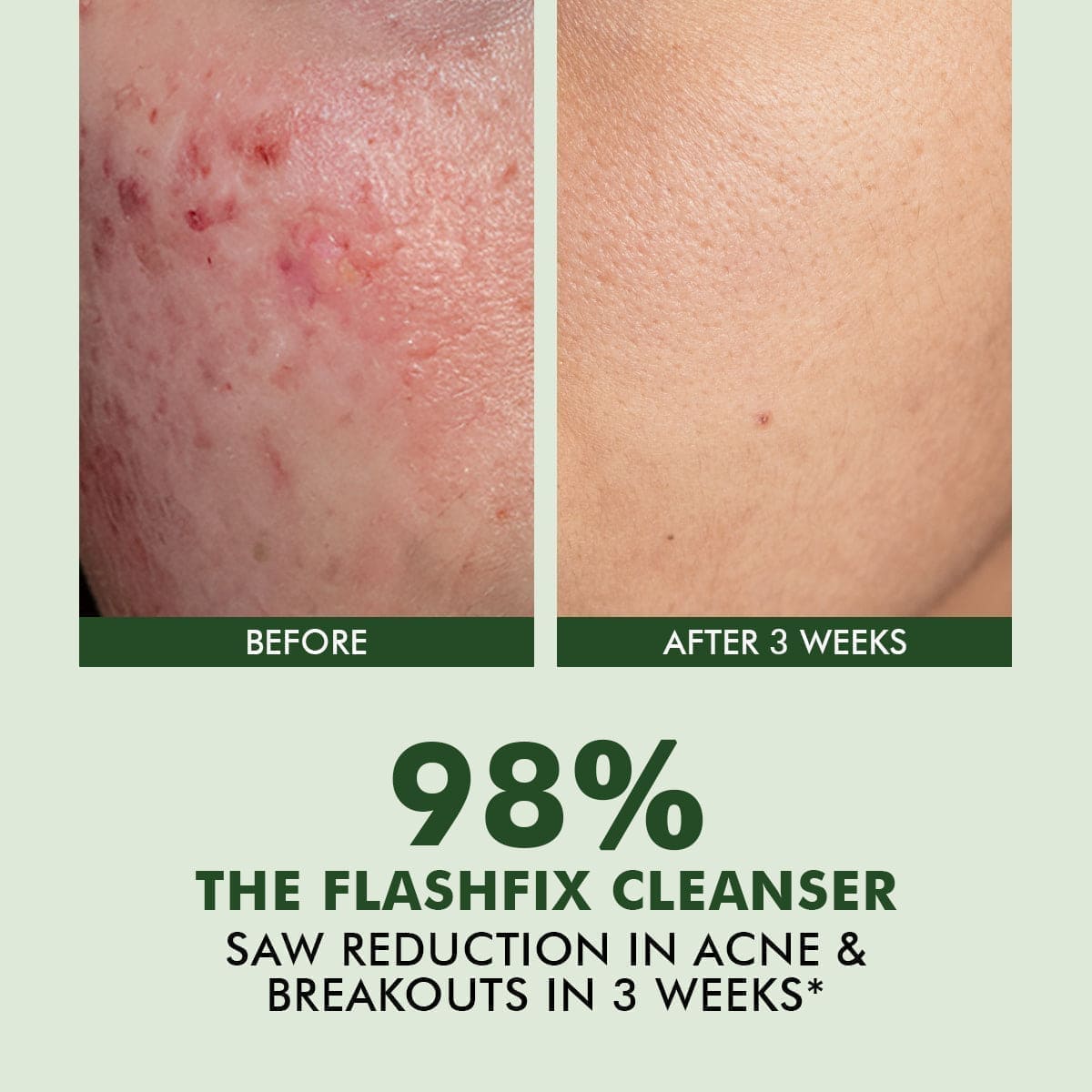 Exfoliating & Oil Control Face Wash | AHA, BHA & CICA Extract | 100 ml