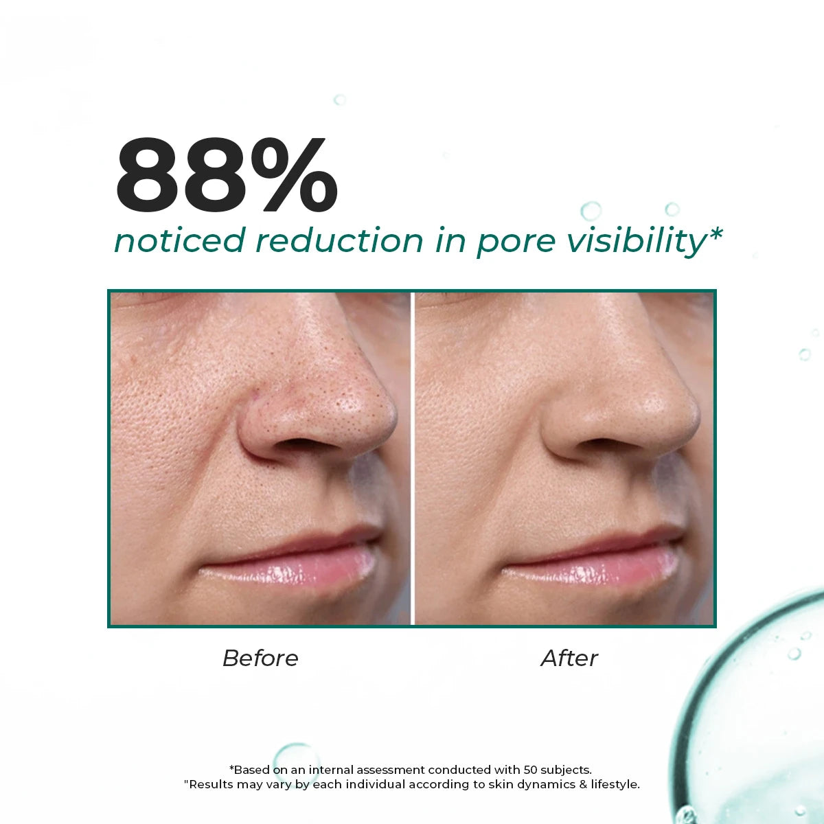 Blackhead Melting Water mini (Pack Of 2) | 100 ml