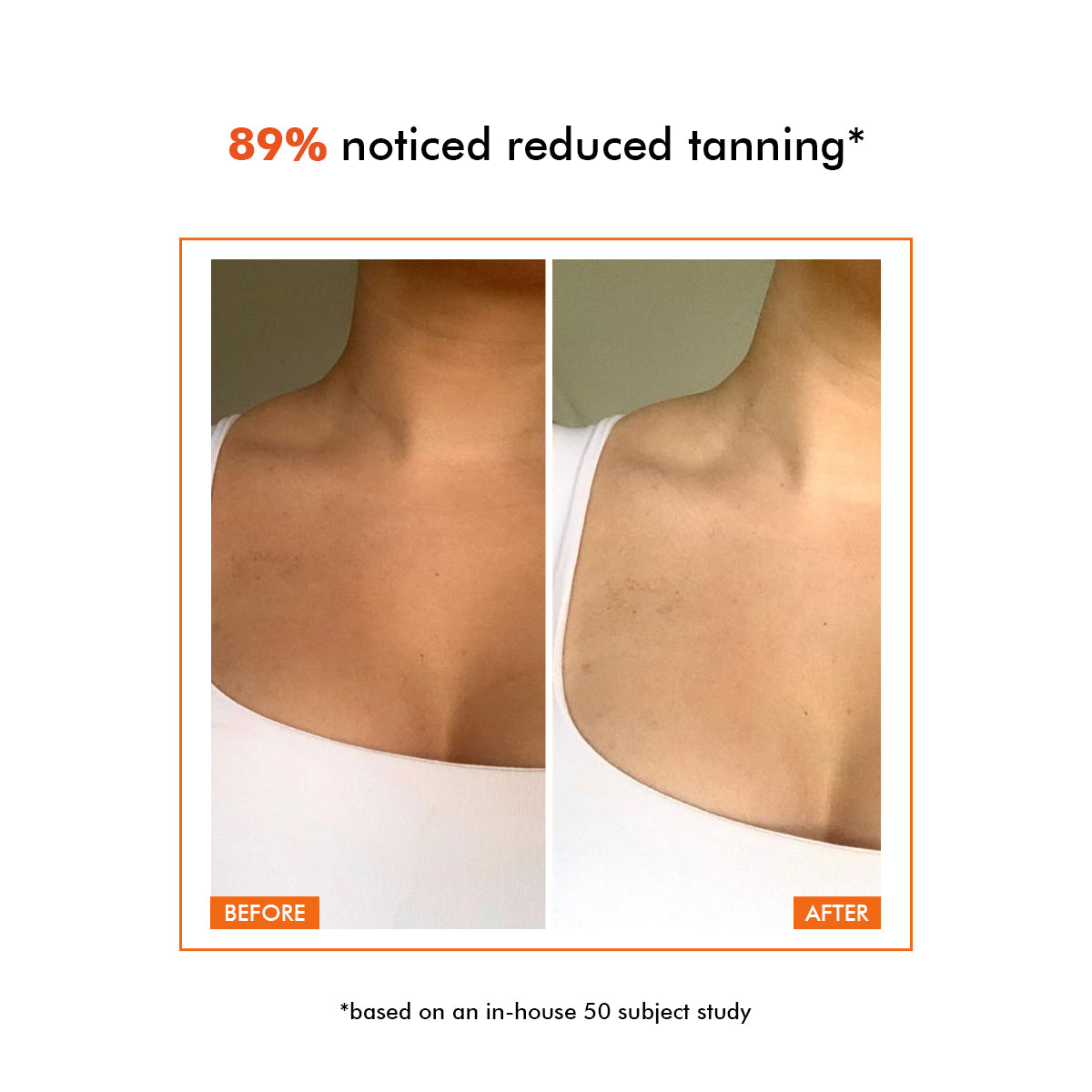 Sunscreen Body Lotion | SPF 50 PA++++ | 150 gm | AF