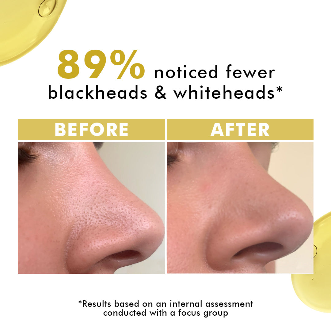 Daily Dissolve Oil Cleanser | 130 ml | Slashed