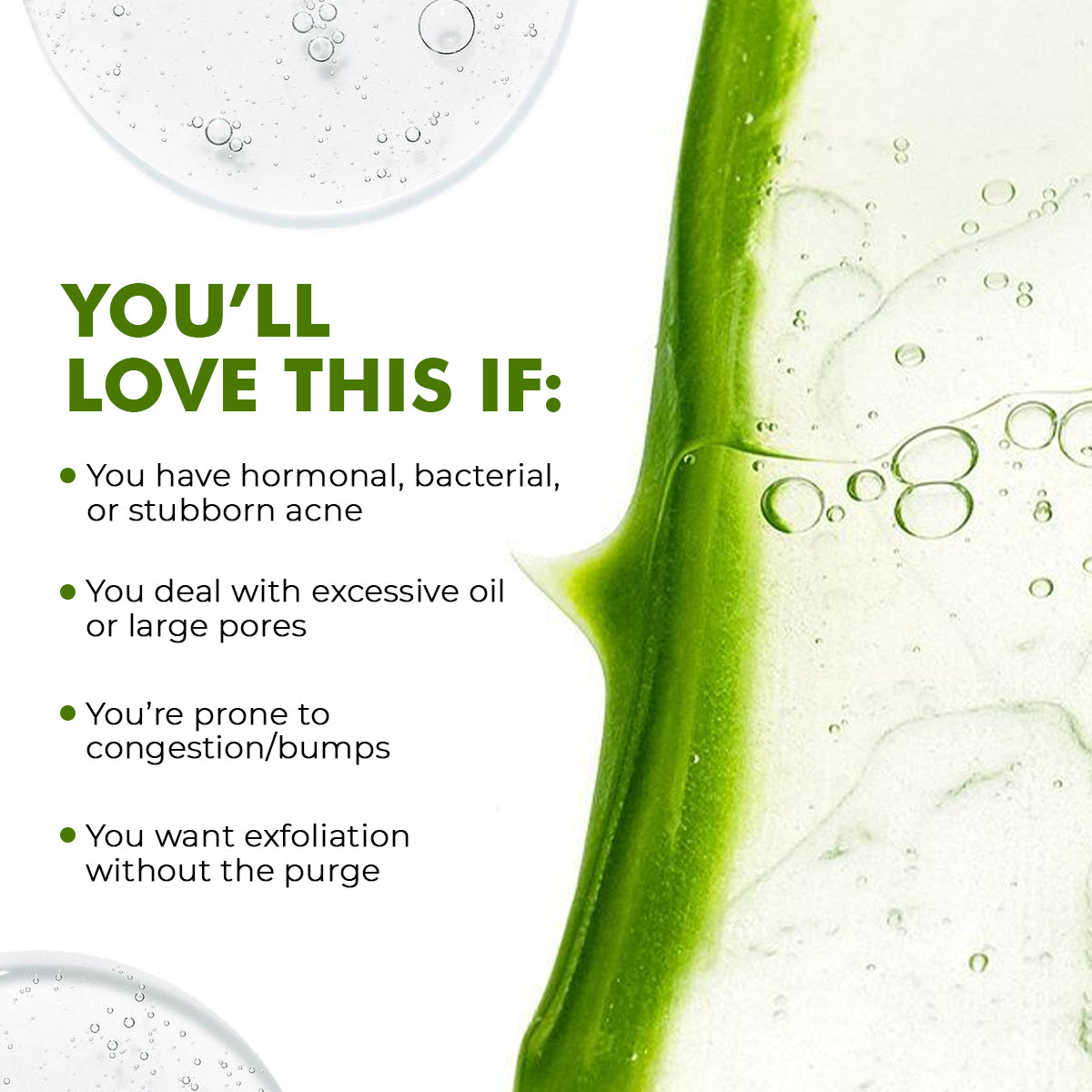 FlashFix Acne Treatment Serum | 2% Salicylic Acid & Willow Bark | 30 ml