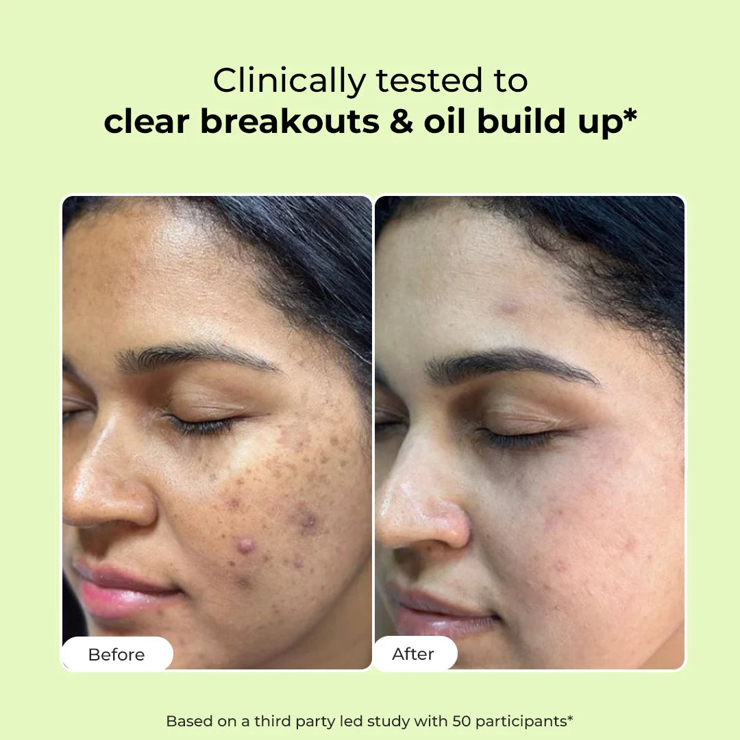 Oil Control & Acne Clearing Exfoliating Face Wash | AHA, BHA & CICA Extract | 100 ml