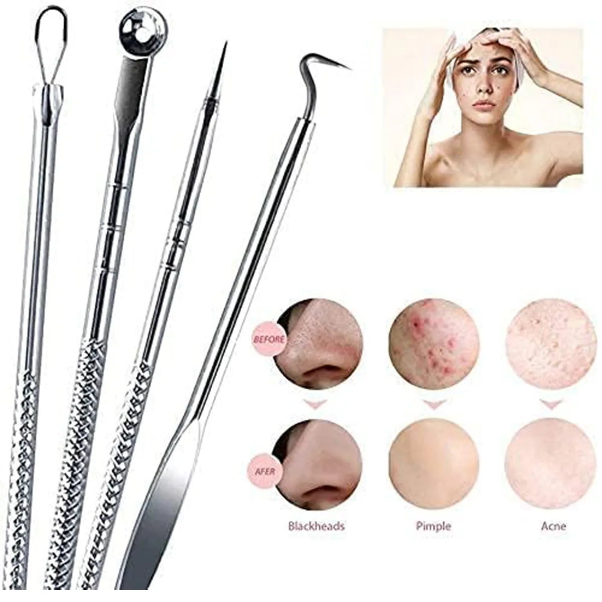 Blackhead Remover Tool | Toolkit | Mini Sale