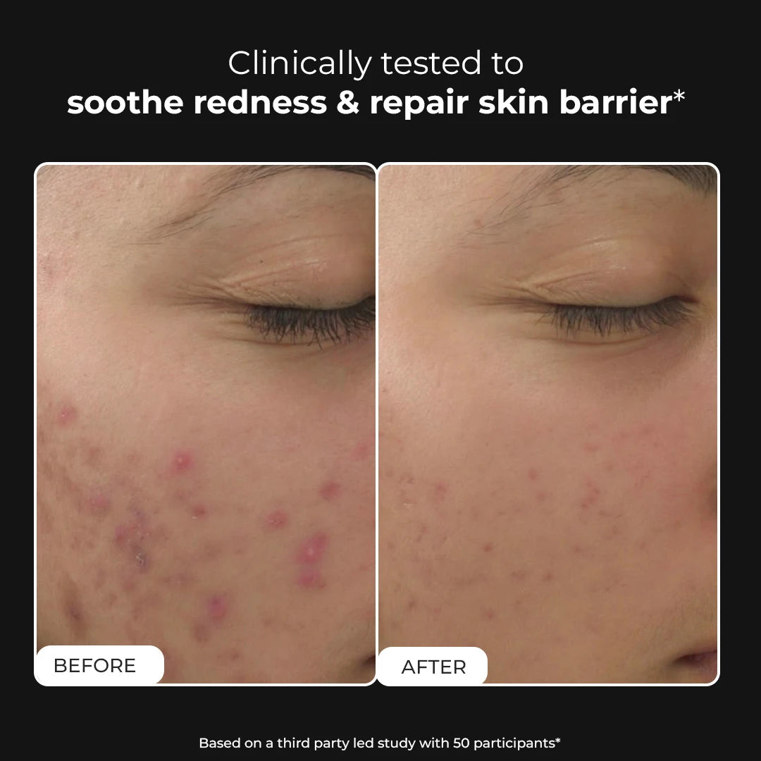 Snail Magic Barrier Repair | 50 Gms