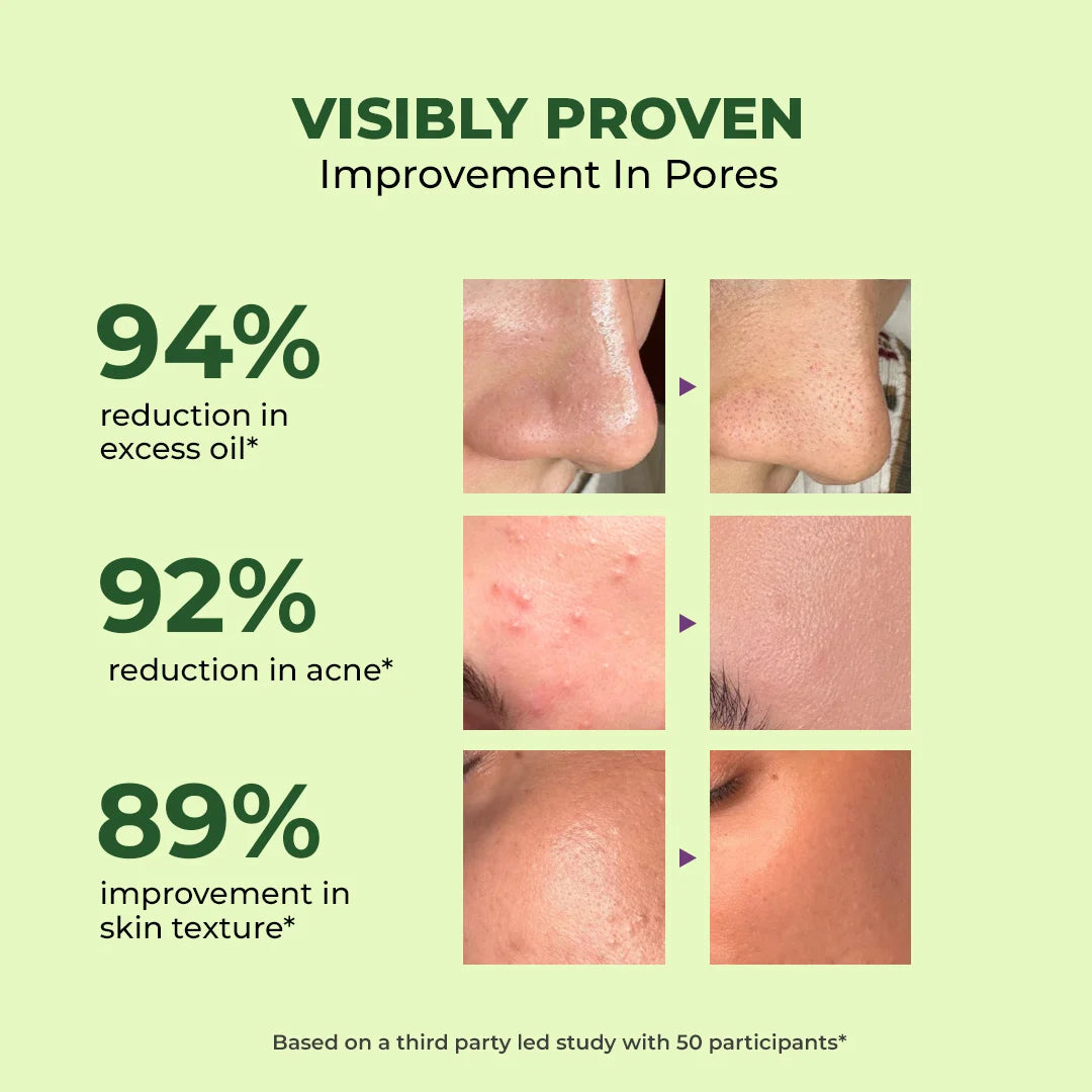 Oil Control & Acne Clearing Exfoliating Face Wash | AHA, BHA & CICA Extract | 100 ml