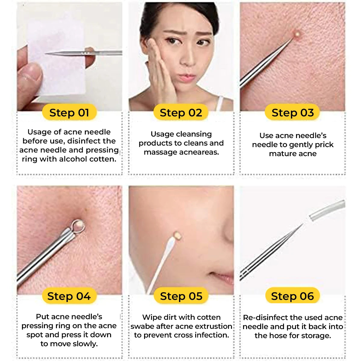 Blackhead Remover Tool | Toolkit