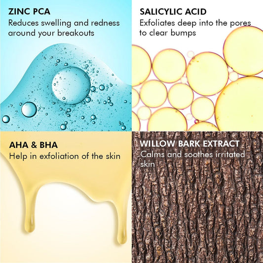 2% Salicylic Acid Serum | Acne Treatment | 0.5% Zinc PCA & Willow Bark Extract