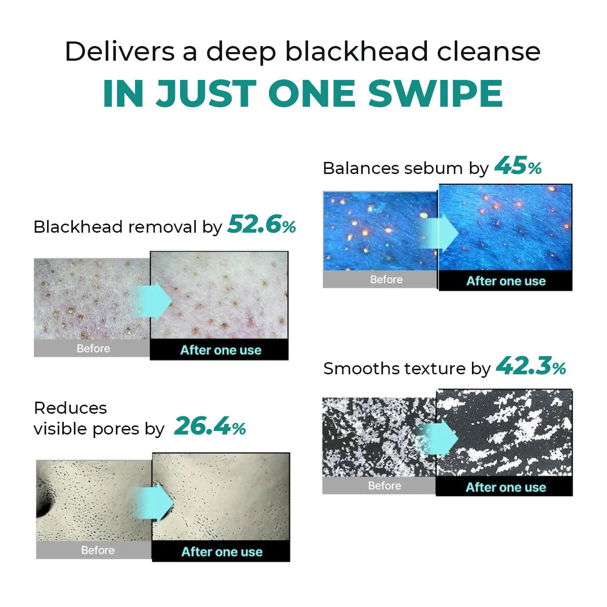 Blackhead Melting Water mini | 50 ml | Flash Sale
