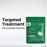 Self Dissolving Microneedle Acne Patches | 8 Patches