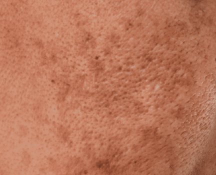 Conscious Chemist skincare concern: hyperpigmentation and uneven tone