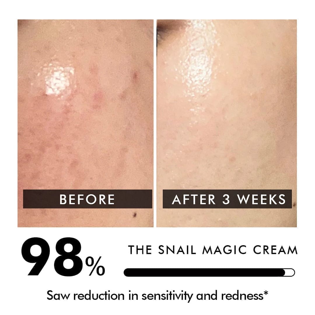 Snail Mucin Barrier Repair Moisturiser | 50 gms | Original Older PDP