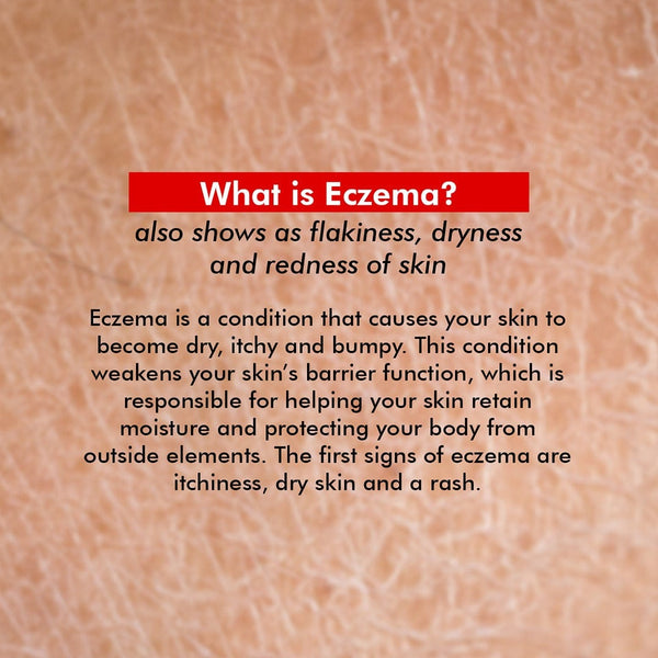 Buy Ceramide Body Lotion Eczema Conscious Chemist