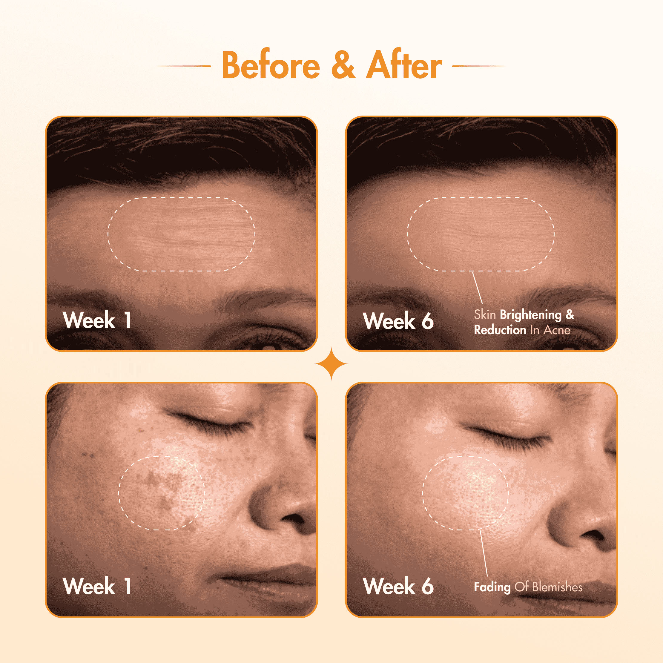 10% Vitamin C Serum | Radiance Booster | 30 ml