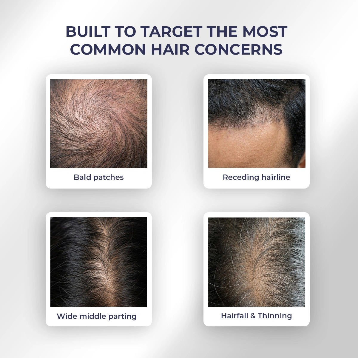 Anti-Hairfall Shampoo | 200 ml