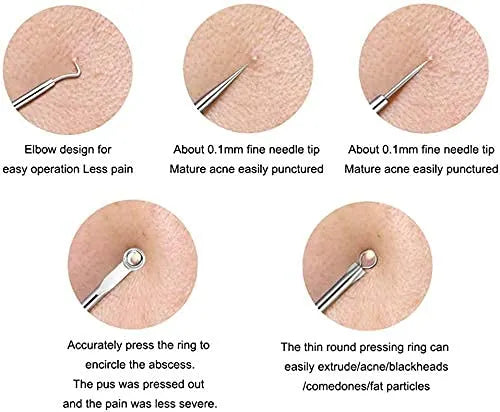 Blackhead Remover Tool | Toolkit