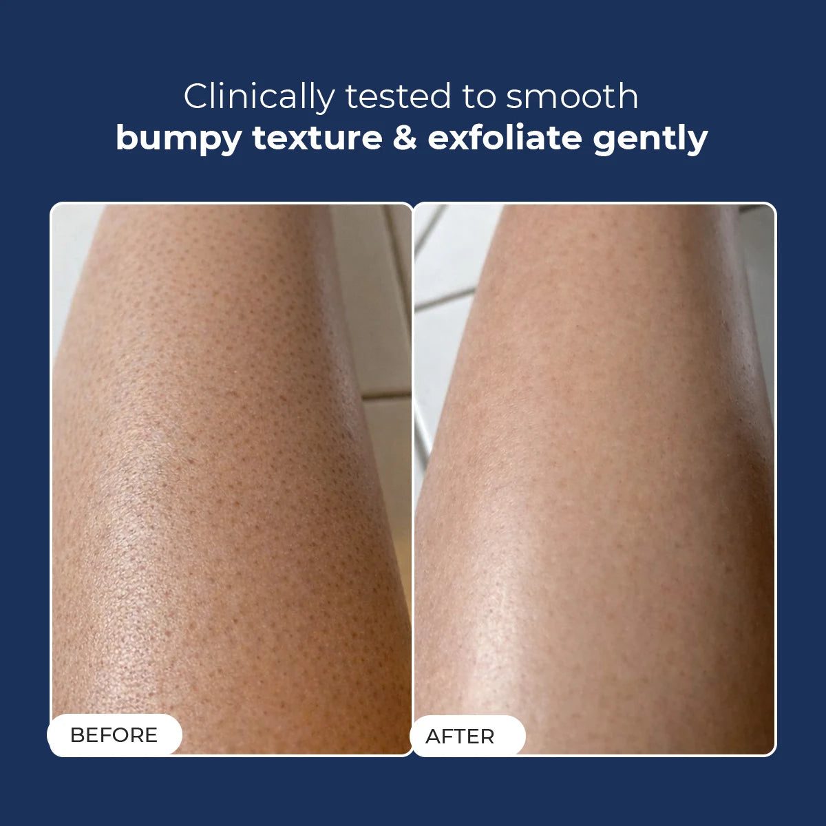 Skin Reset Exfoliating Bodywash