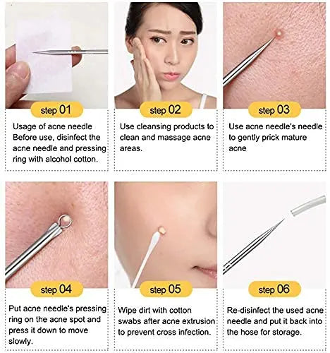 Blackhead Remover Tool | Toolkit