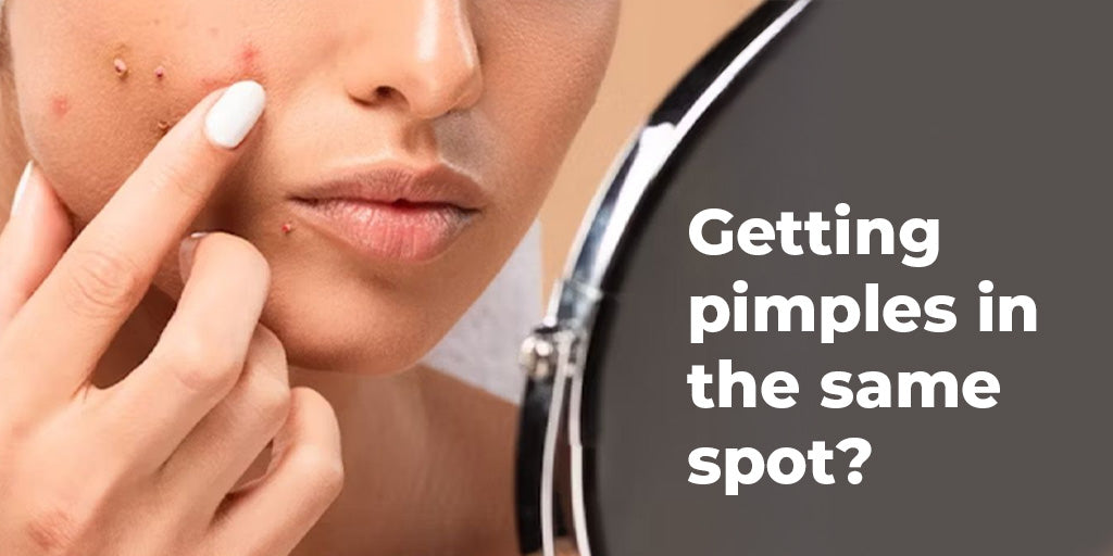 Why You Keep Getting Pimples in the Same Spot (and How to Stop It)