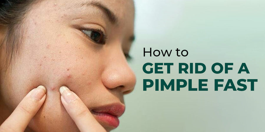 How to Get Rid of a Pimple Fast