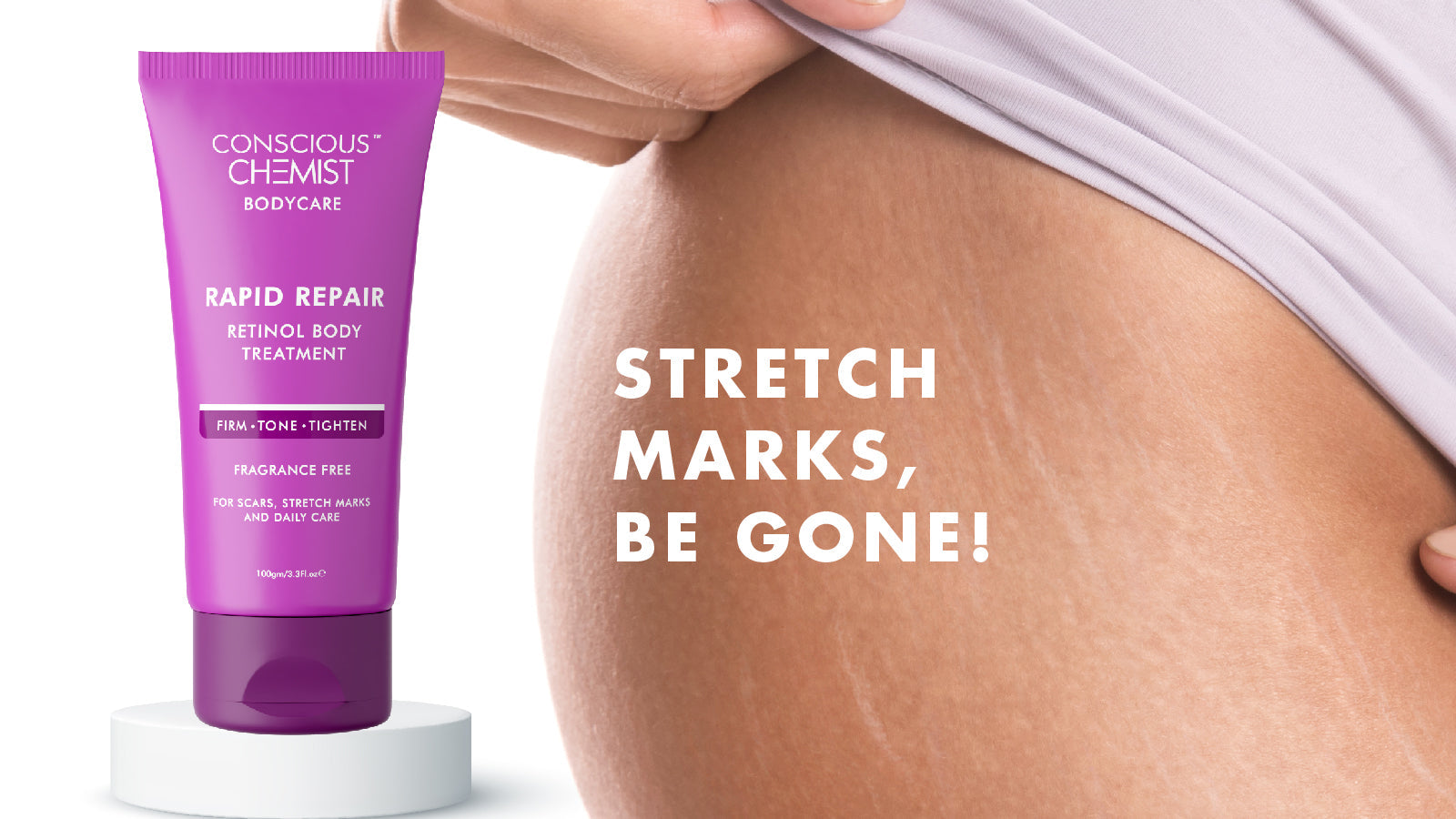 Stretch marks removal cream