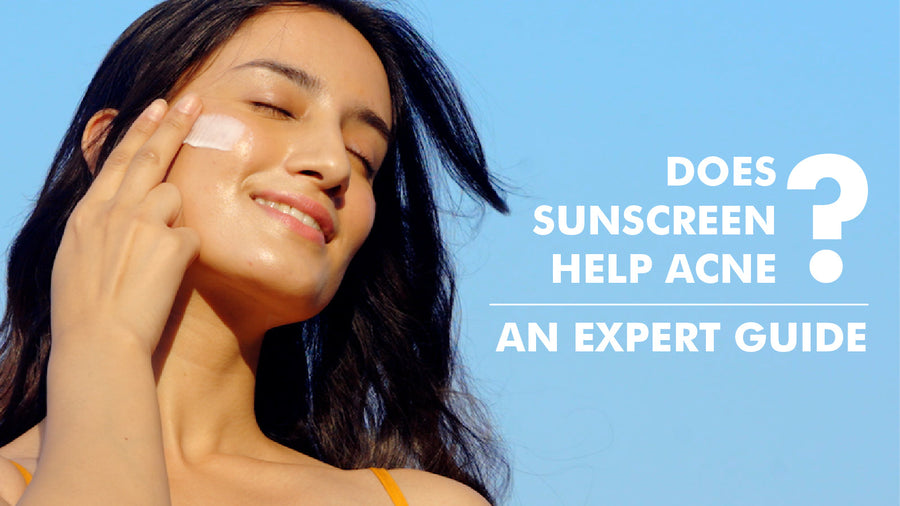 Does Sunscreen Help Acne? An Expert Guide