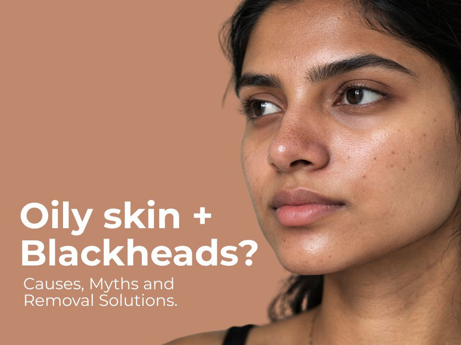 Oily Skin Blackheads: Causes, Myths and Removal Solutions