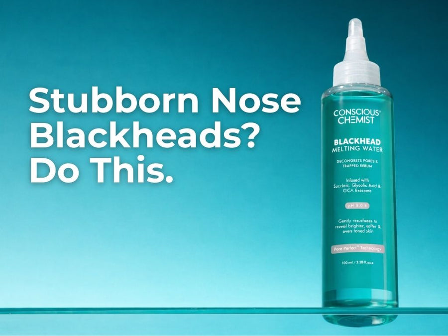 Stop Fighting Your Pores: A Long-Term Plan for Nose Blackheads