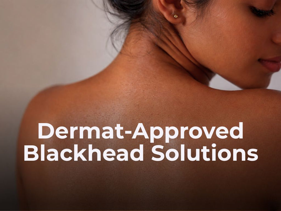 A Dermat-Approved Guide to Treating Blackheads: Ingredients, Routines, Proven Results