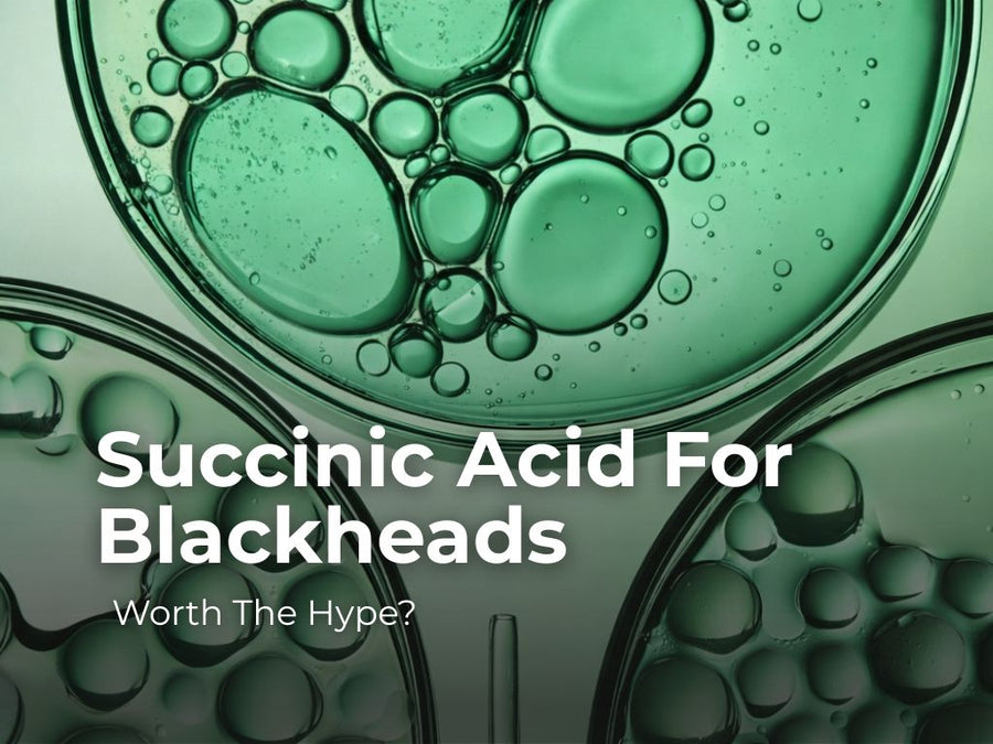 A Practical Approach to Remove Blackhead With Succinic Acid
