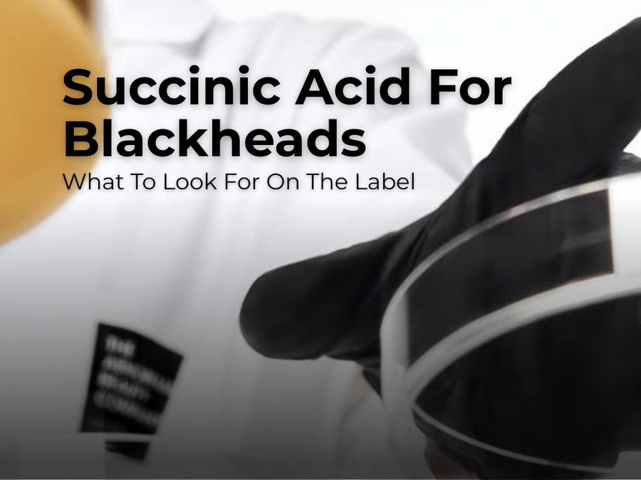 Succinic Acid for Blackheads: What to Look for in a Blackhead Remover?