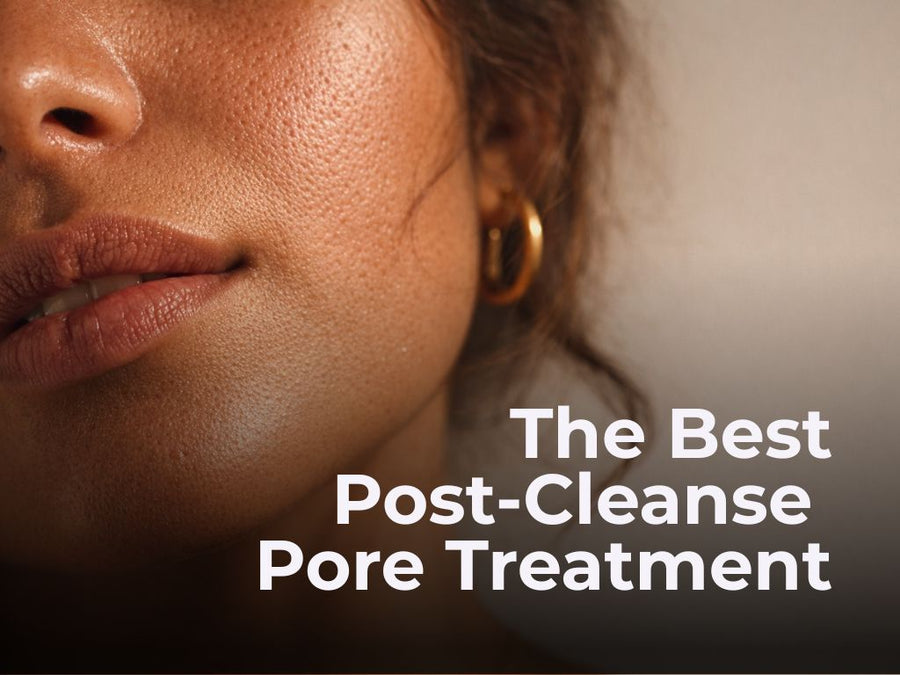 Best Treatment to Use After Cleansing to Keep Pores Clear
