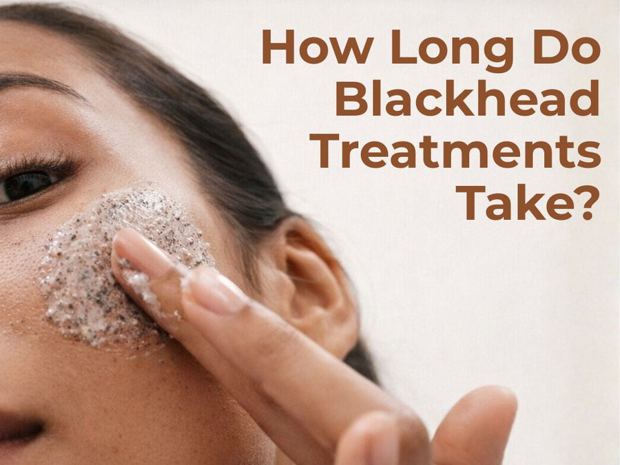 How Long Does a Blackhead Treatment Take to Work?