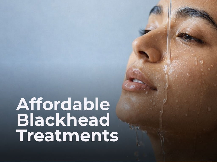 A Guide on Budget-friendly Blackhead Treatment